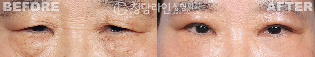 Before Image