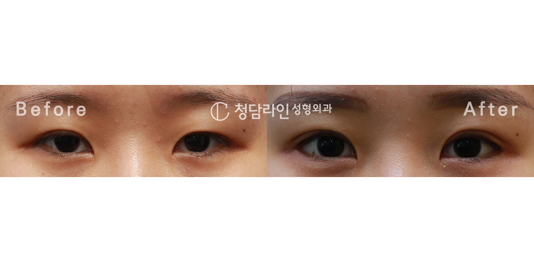 Before Image