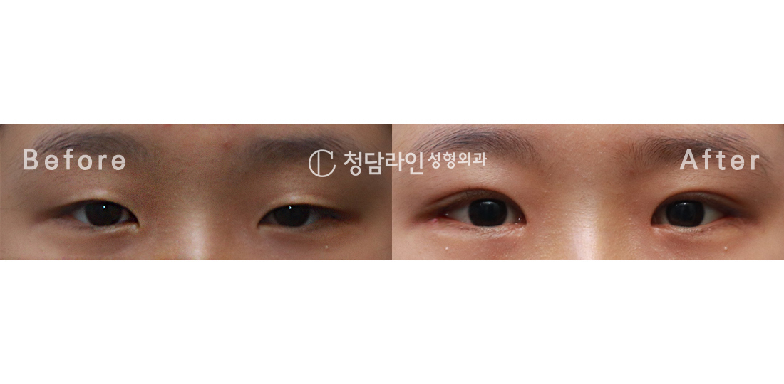 Before Image