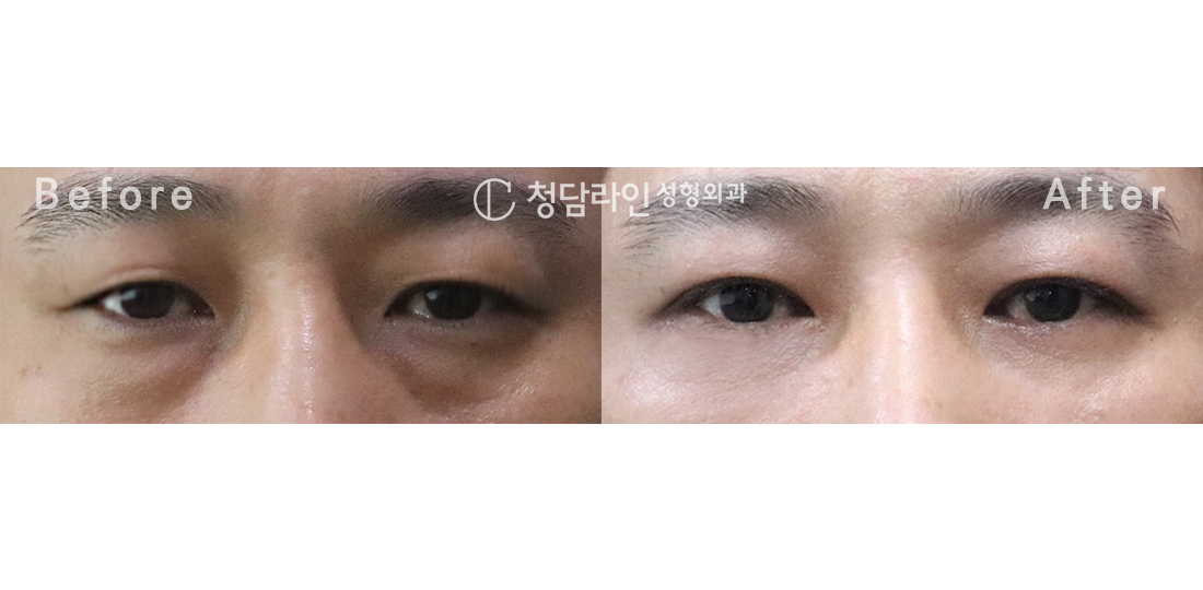 Before Image