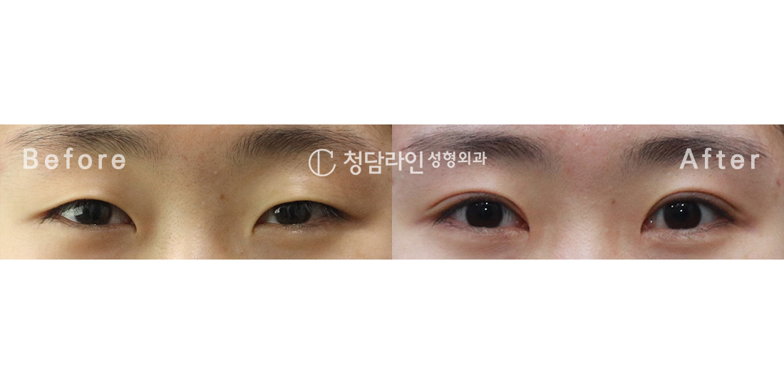 Before Image