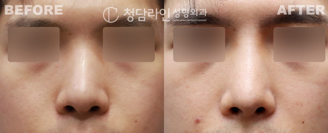 Before Image