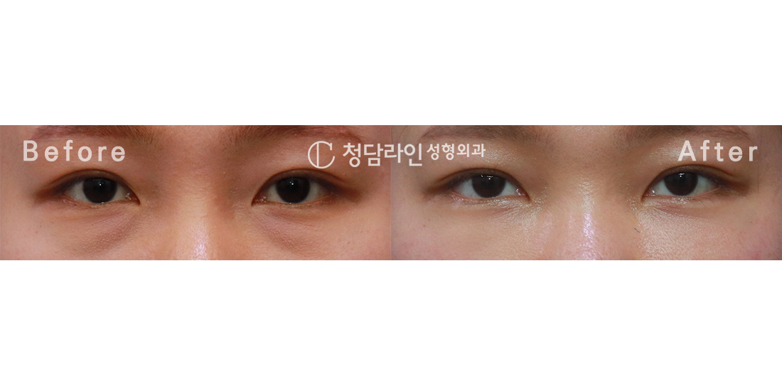 Before Image
