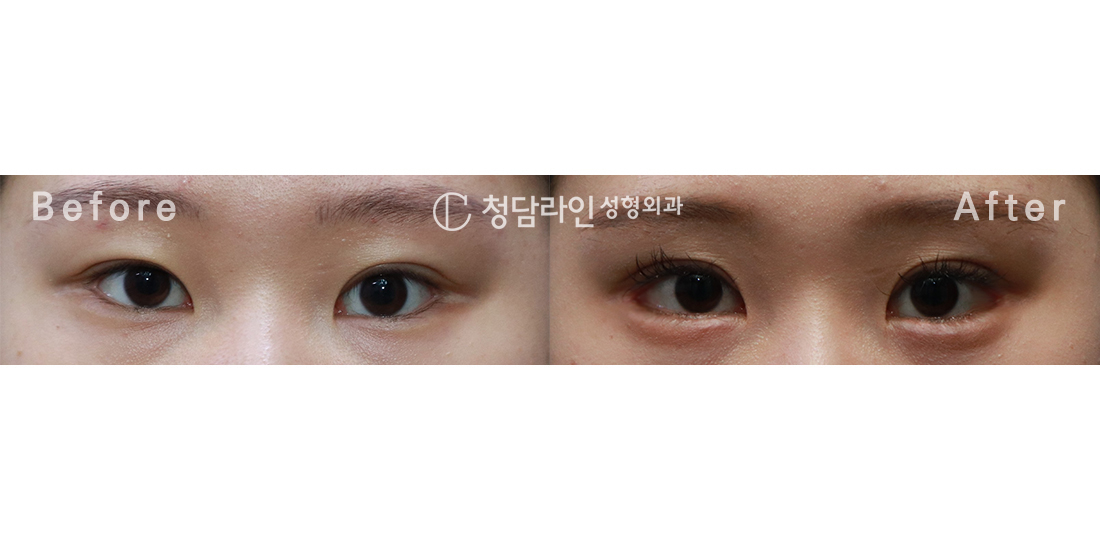 Before Image