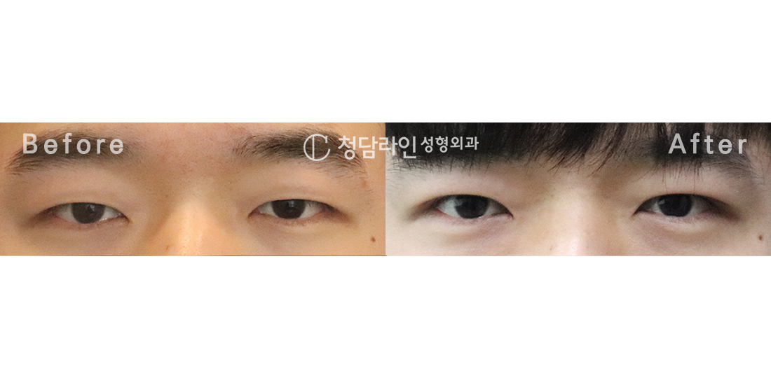 Before Image