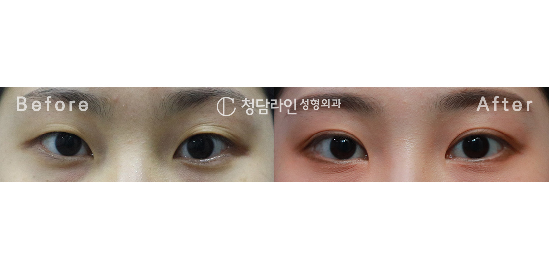 Before Image
