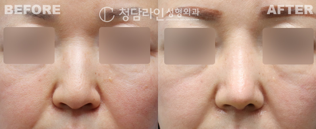 Before Image
