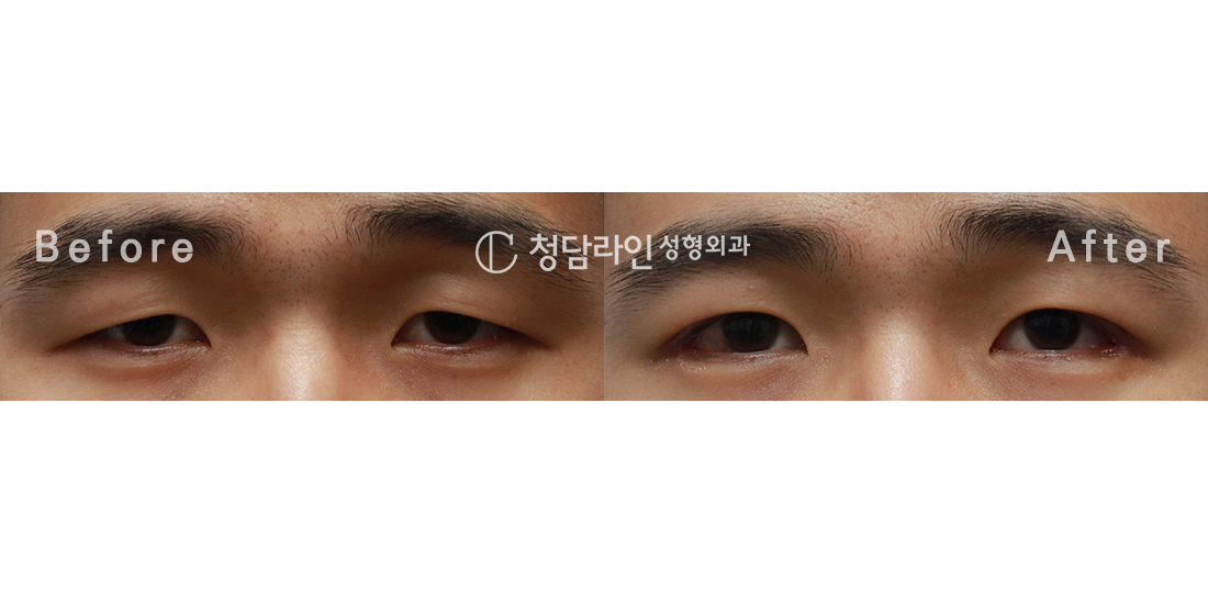 Before Image