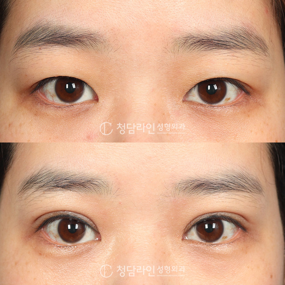 Before Image