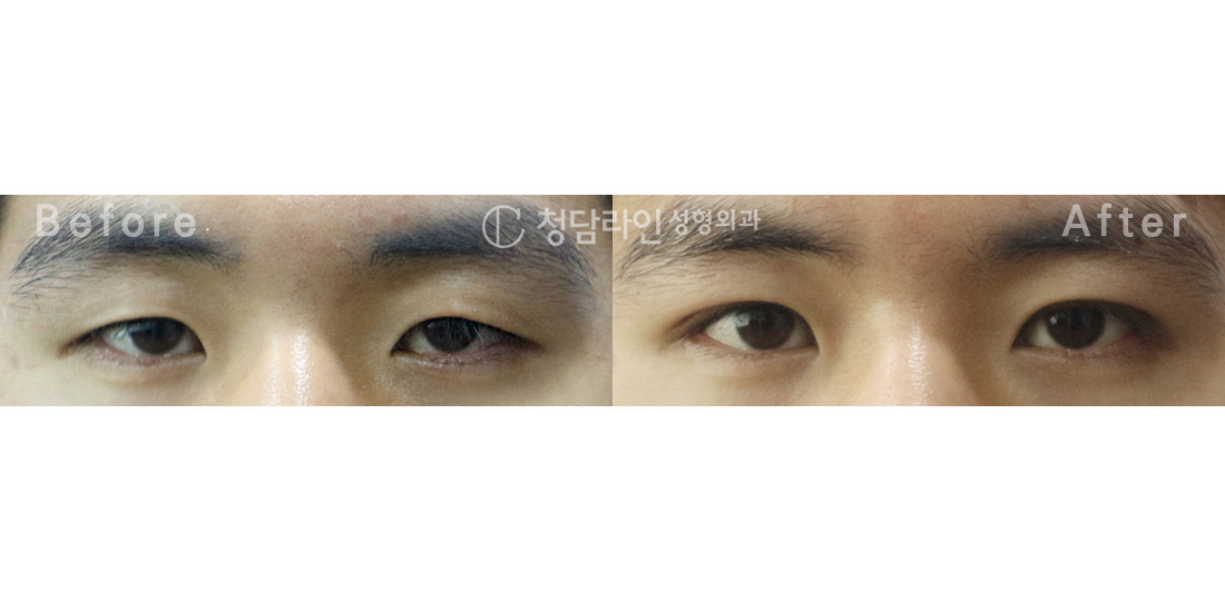Before Image