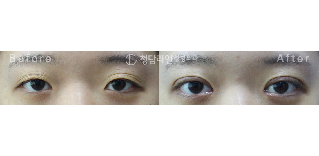 Before Image