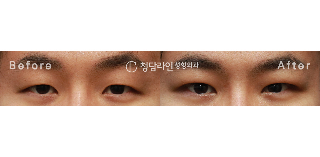 Before Image