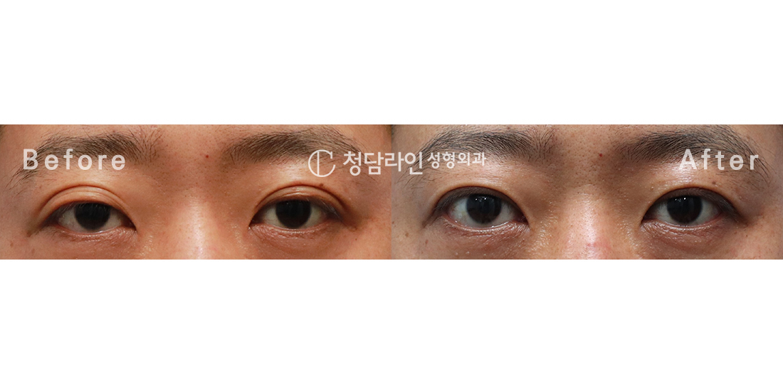 Before Image