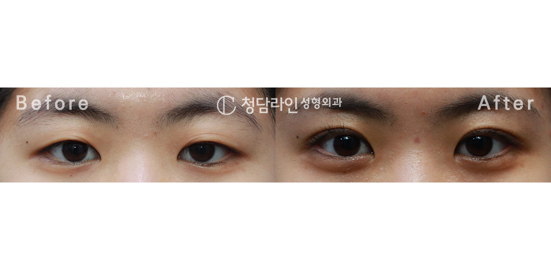 Before Image