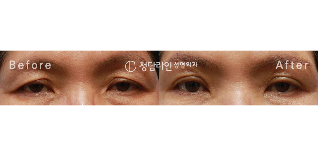 Before Image