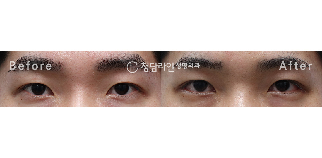 Before Image