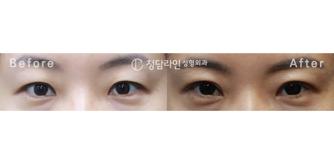 Before Image