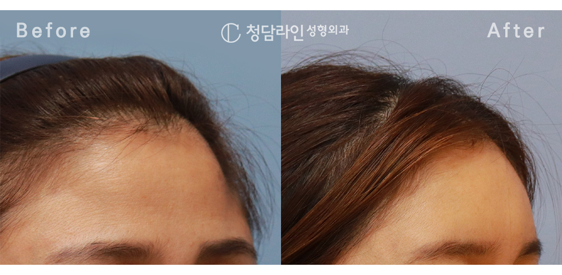 Before Image 3