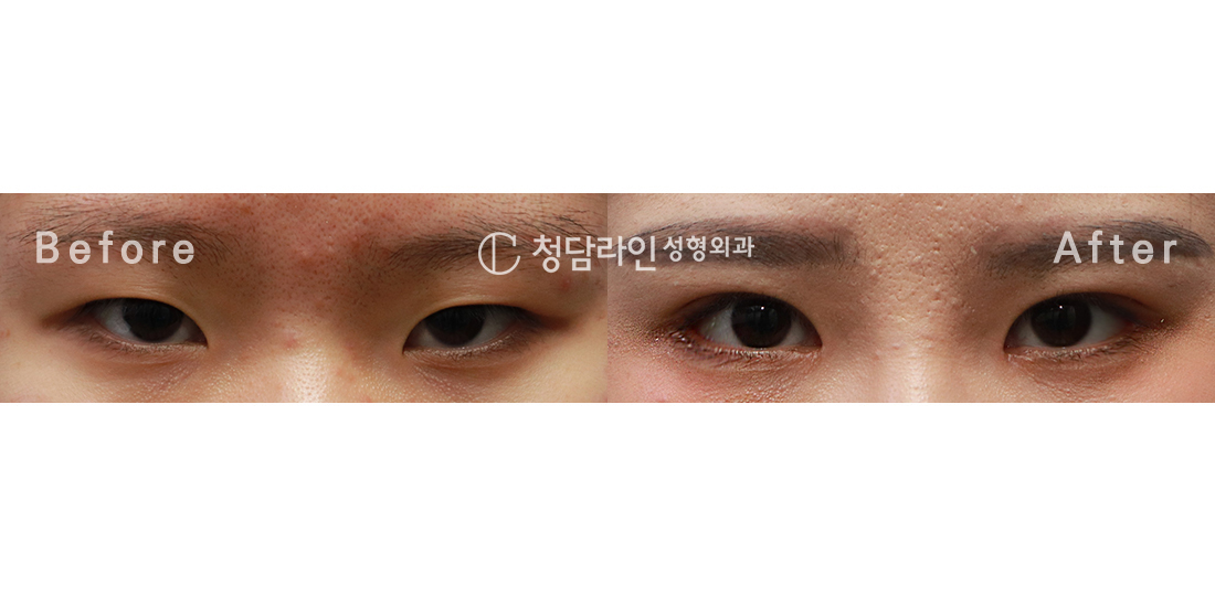 Before Image