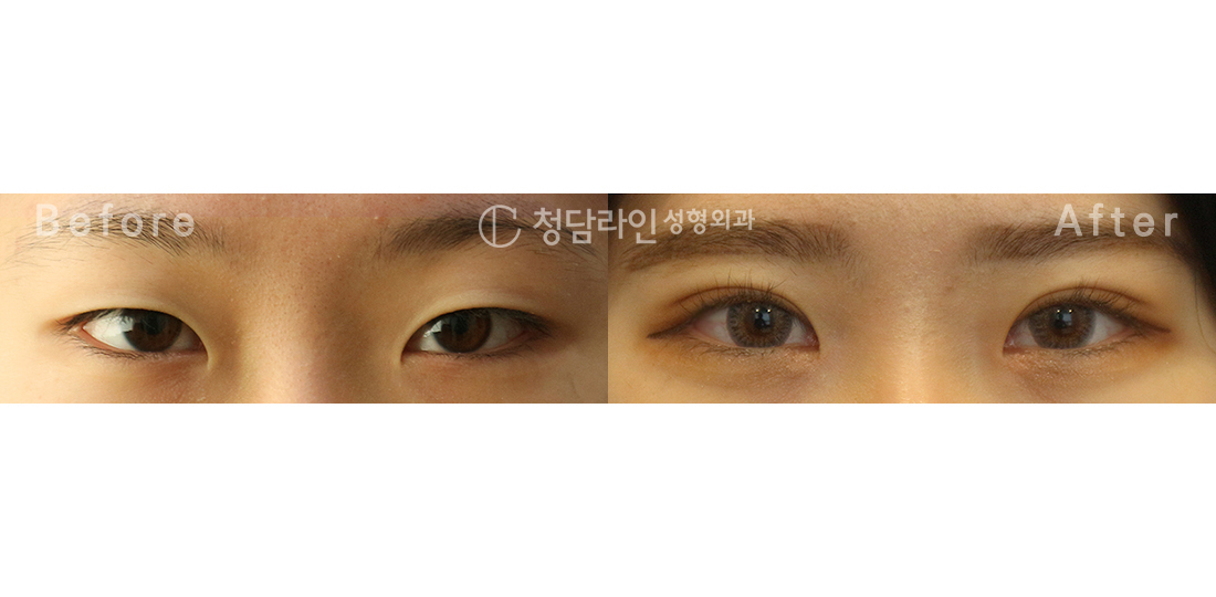 Before Image