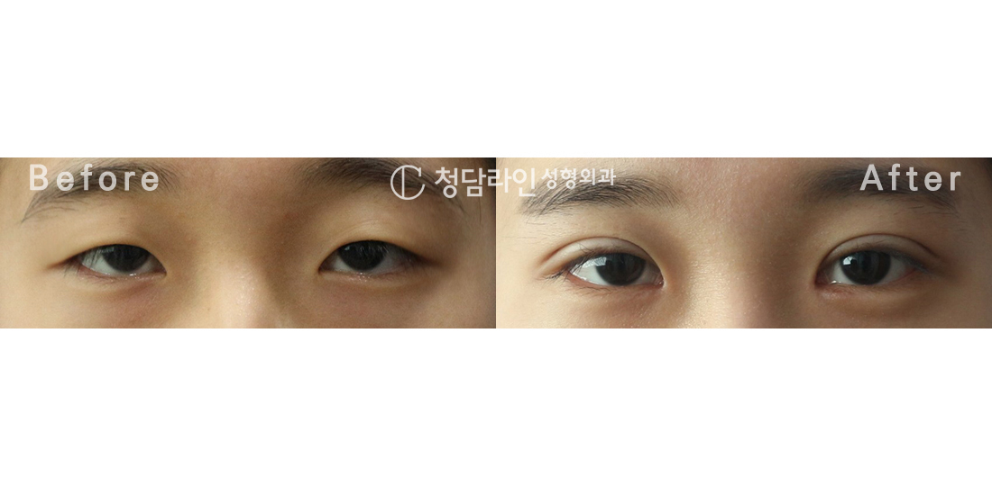 Before Image