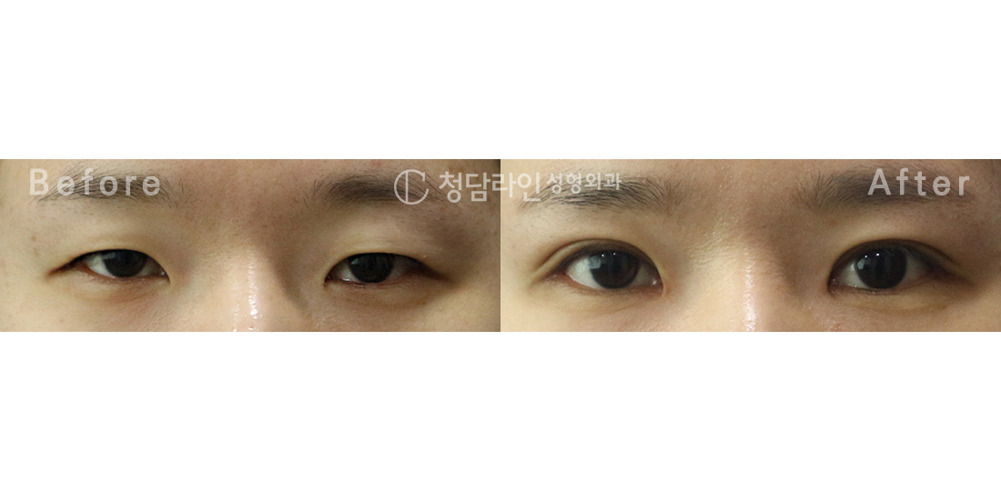 Before Image
