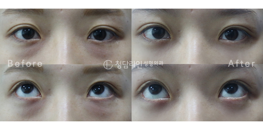 Before Image