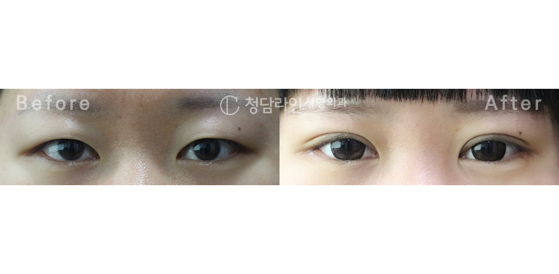 Before Image