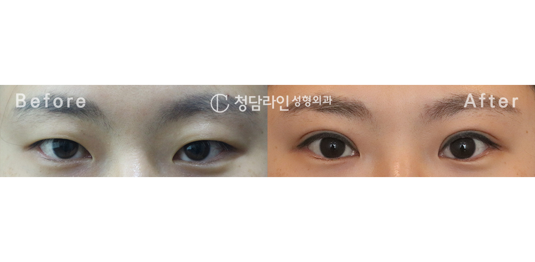 Before Image