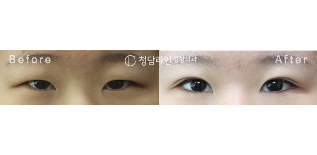 Before Image
