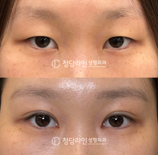 Before Image