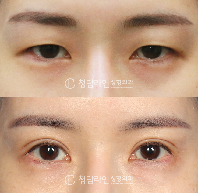 Before Image