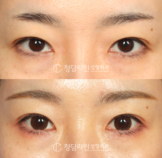 Before Image