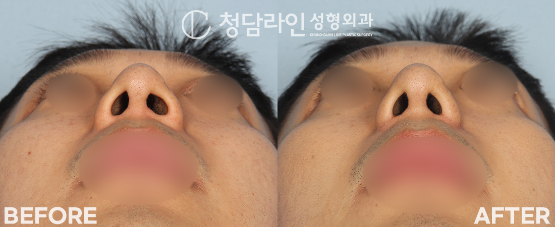 Before Image