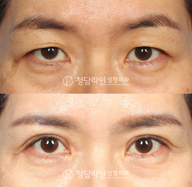 Before Image