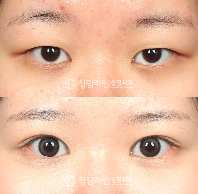 Before Image