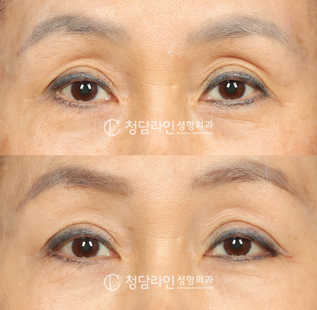 Before Image