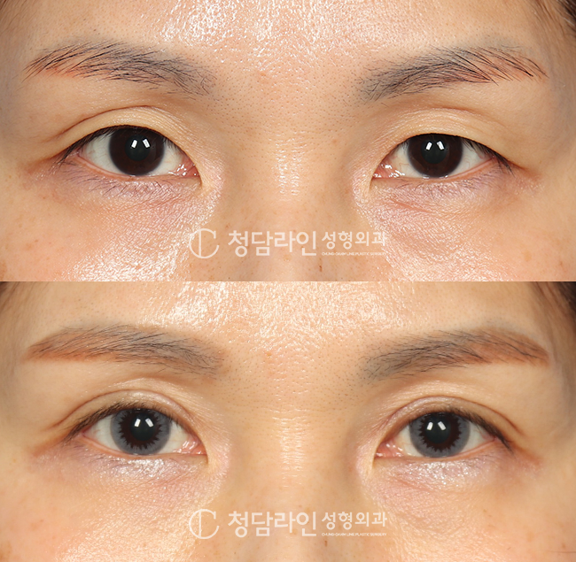 Before Image