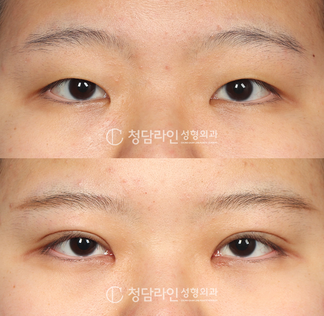 Before Image