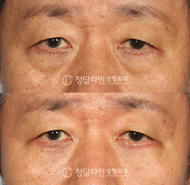 Before Image