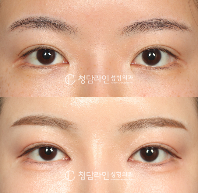 Before Image