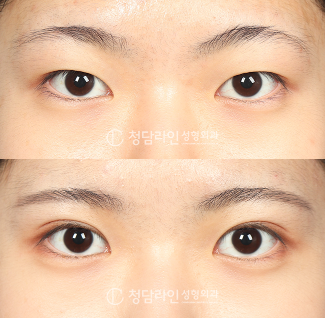 Before Image