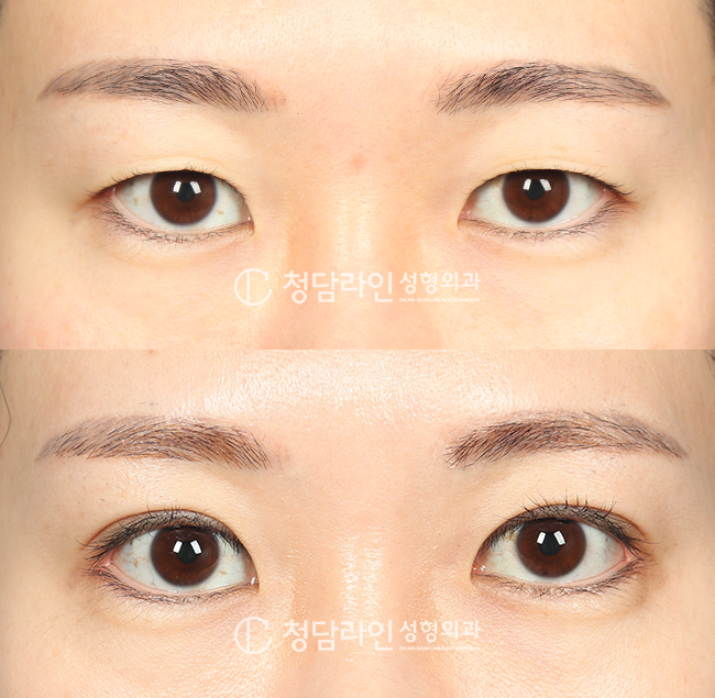 Before Image