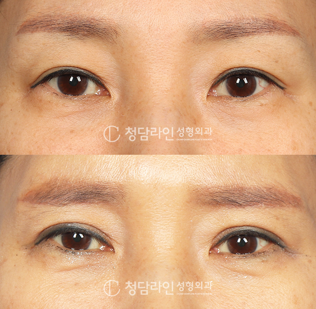 Before Image