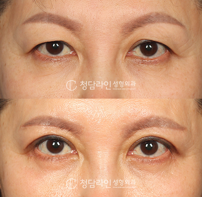 Before Image