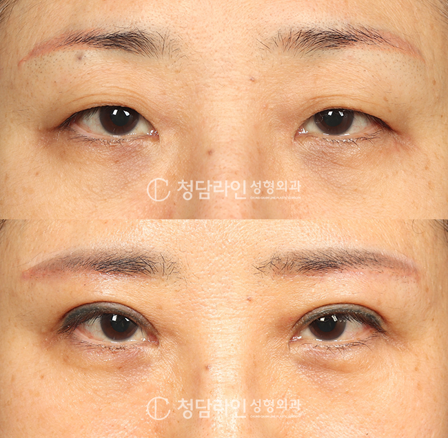 Before Image
