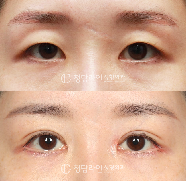 Before Image