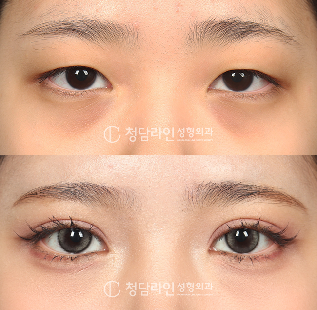 Before Image