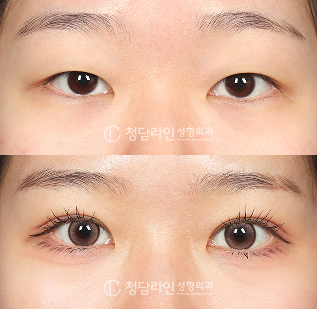 Before Image