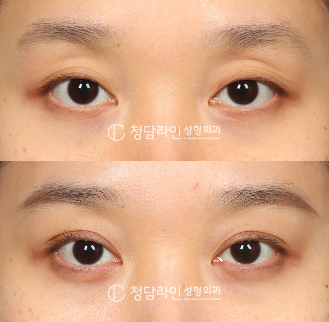Before Image